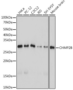 CHMP2B Antibody in Western Blot (WB)