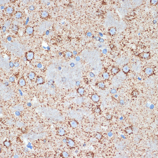 GOT2 Antibody in Immunohistochemistry (Paraffin) (IHC (P))