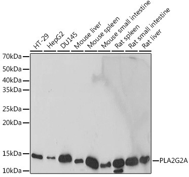 PLA2G2A Antibody in Western Blot (WB)