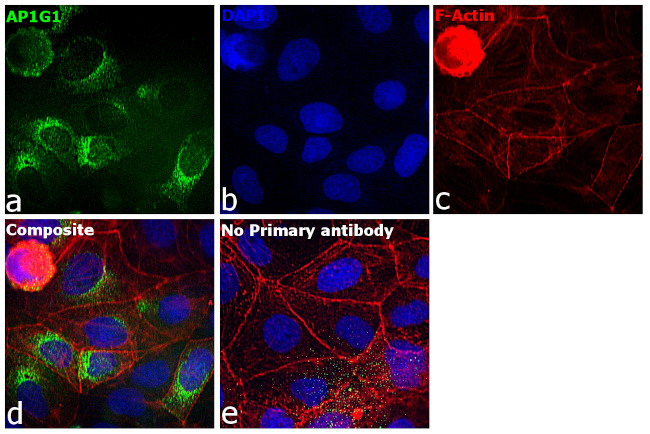 gamma Adaptin Antibody in Immunocytochemistry (ICC/IF)