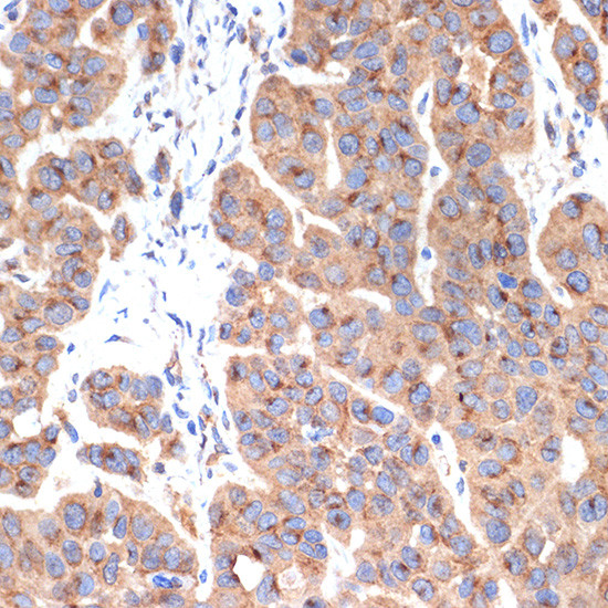 gamma Adaptin Antibody in Immunohistochemistry (Paraffin) (IHC (P))