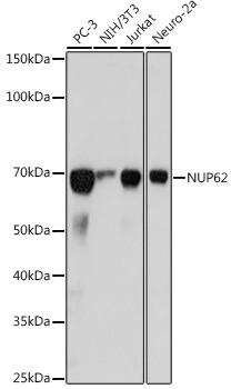 NUP62 Antibody in Western Blot (WB)