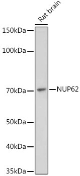 NUP62 Antibody in Western Blot (WB)