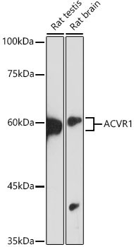 ACVR1 Antibody in Western Blot (WB)