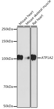 ATP1A2 Antibody in Western Blot (WB)