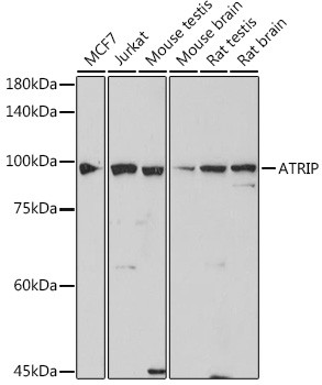 ATRIP Antibody in Western Blot (WB)