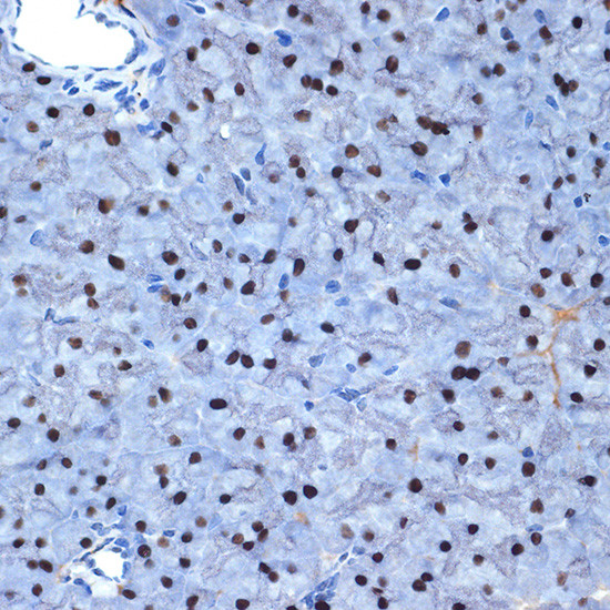 NAT10 Antibody in Immunohistochemistry (Paraffin) (IHC (P))