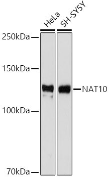 NAT10 Antibody in Western Blot (WB)