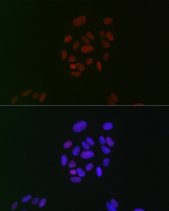 CIRBP Antibody in Immunocytochemistry (ICC/IF)