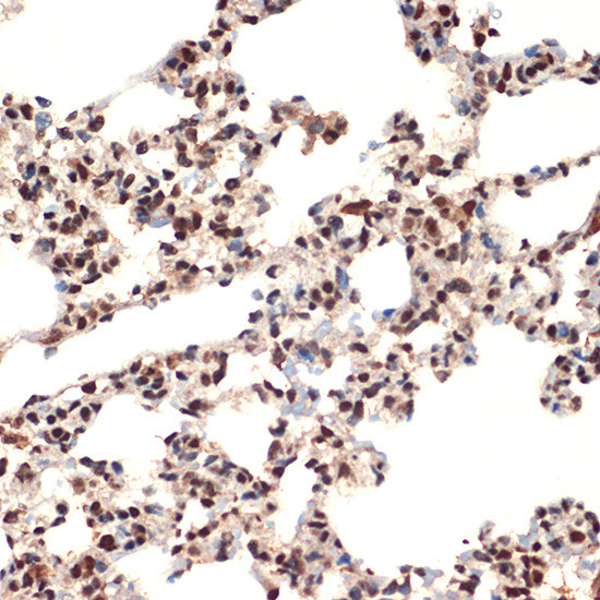 CIRBP Antibody in Immunohistochemistry (Paraffin) (IHC (P))