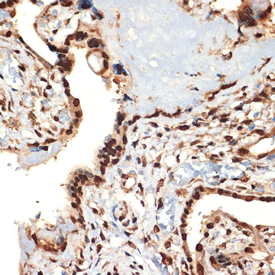 CIRBP Antibody in Immunohistochemistry (Paraffin) (IHC (P))