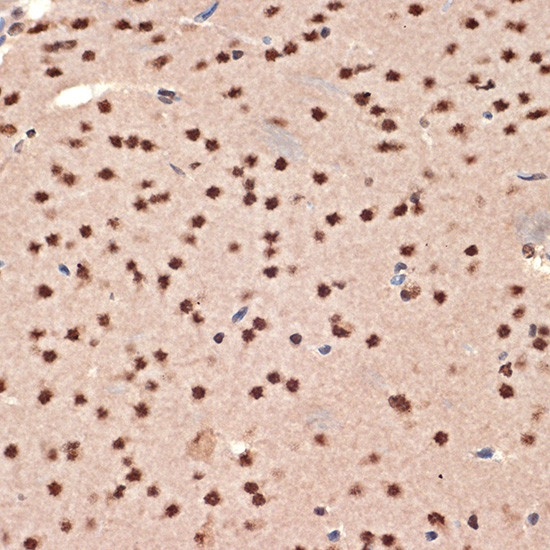 CIRBP Antibody in Immunohistochemistry (Paraffin) (IHC (P))