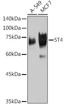 5T4 Antibody in Western Blot (WB)