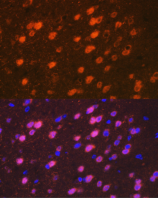 TBR1 Antibody in Immunocytochemistry (ICC/IF)