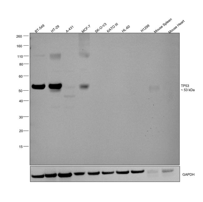 p53 Antibody in Western Blot (WB)