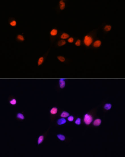 Androgen Receptor Antibody in Immunocytochemistry (ICC/IF)