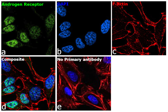 Androgen Receptor Antibody in Immunocytochemistry (ICC/IF)