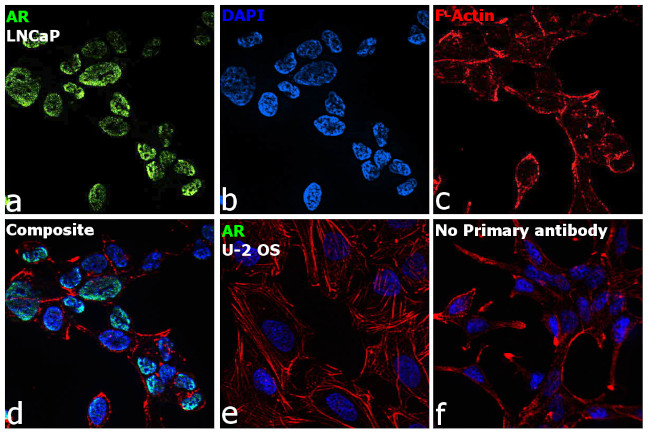 Androgen Receptor Antibody in Immunocytochemistry (ICC/IF)