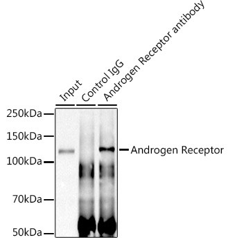 Androgen Receptor Antibody in Immunoprecipitation (IP)