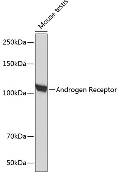 Androgen Receptor Antibody in Western Blot (WB)