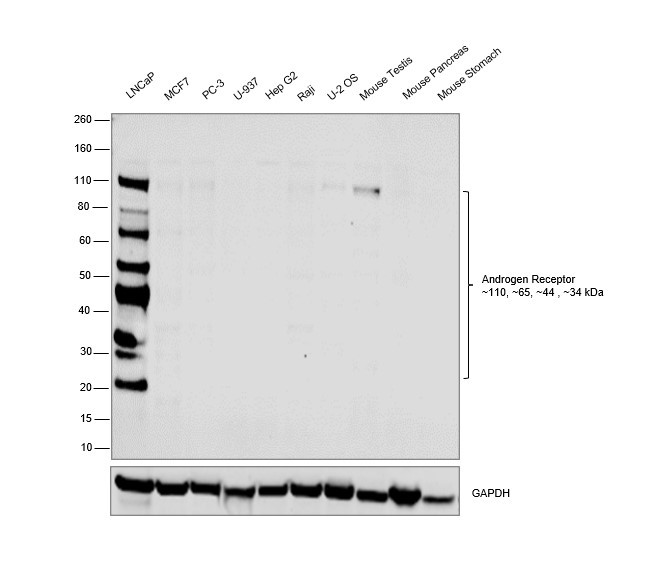 Androgen Receptor Antibody in Western Blot (WB)