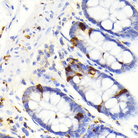 SCGN Antibody in Immunohistochemistry (Paraffin) (IHC (P))