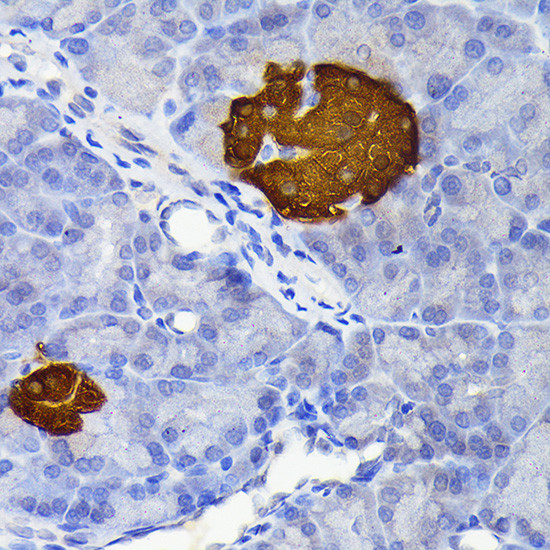 SCGN Antibody in Immunohistochemistry (Paraffin) (IHC (P))