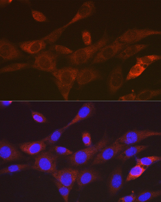 TACC3 Antibody in Immunocytochemistry (ICC/IF)