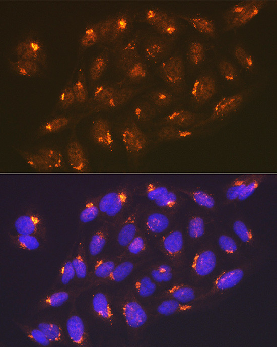 TGN46 Antibody in Immunocytochemistry (ICC/IF)