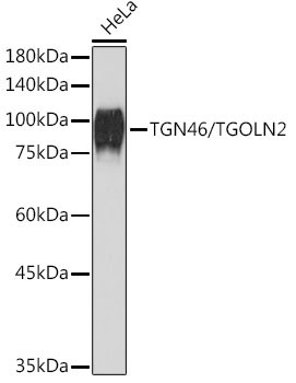 TGN46 Antibody in Western Blot (WB)