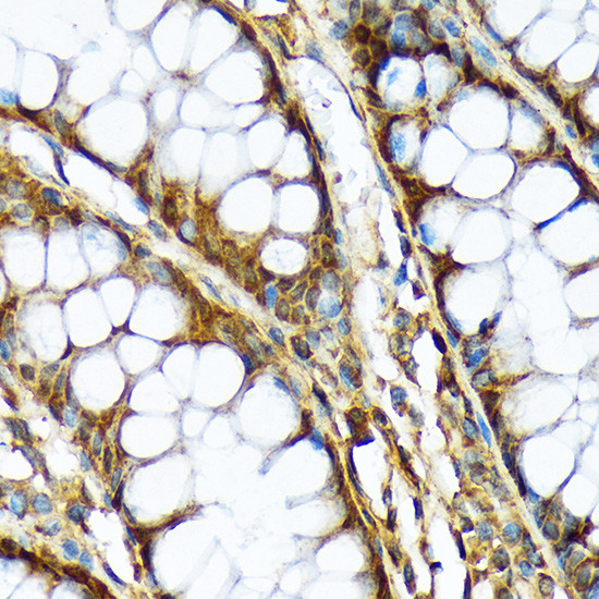 ABCF1 Antibody in Immunohistochemistry (Paraffin) (IHC (P))