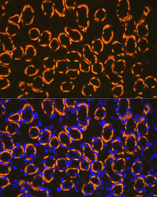 CDH16 Antibody in Immunocytochemistry (ICC/IF)