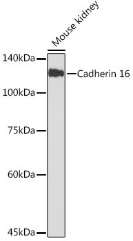 CDH16 Antibody in Western Blot (WB)