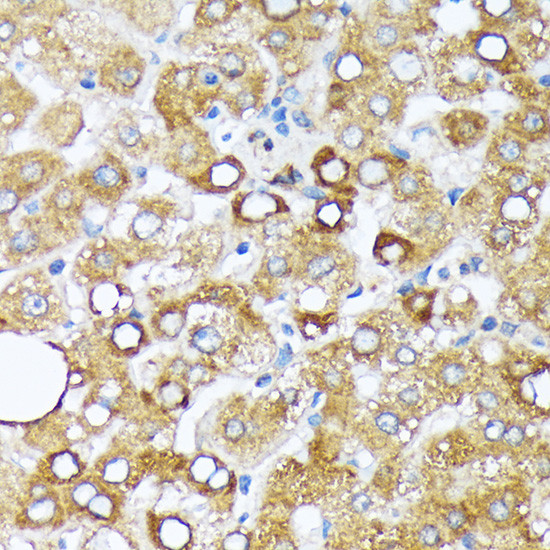 CYP4A11/CYP4A22 Antibody in Immunohistochemistry (Paraffin) (IHC (P))