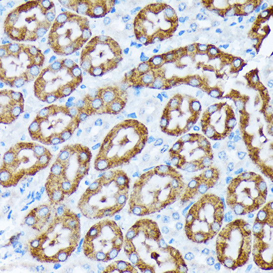 CYP4A11/CYP4A22 Antibody in Immunohistochemistry (Paraffin) (IHC (P))