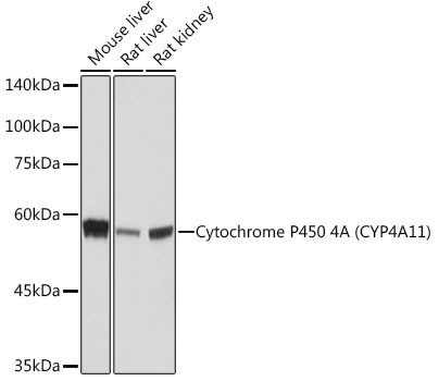 CYP4A11/CYP4A22 Antibody in Western Blot (WB)