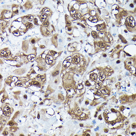 Ubiquitin Antibody in Immunohistochemistry (Paraffin) (IHC (P))