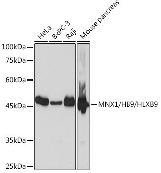 HB9 Antibody in Western Blot (WB)