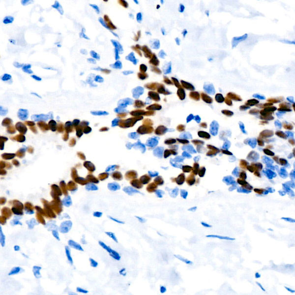 Progesterone Receptor Antibody in Immunohistochemistry (Paraffin) (IHC (P))