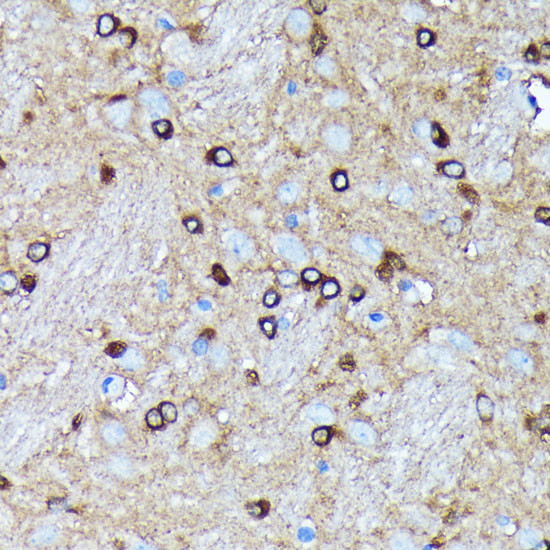 AGO2 Antibody in Immunohistochemistry (Paraffin) (IHC (P))