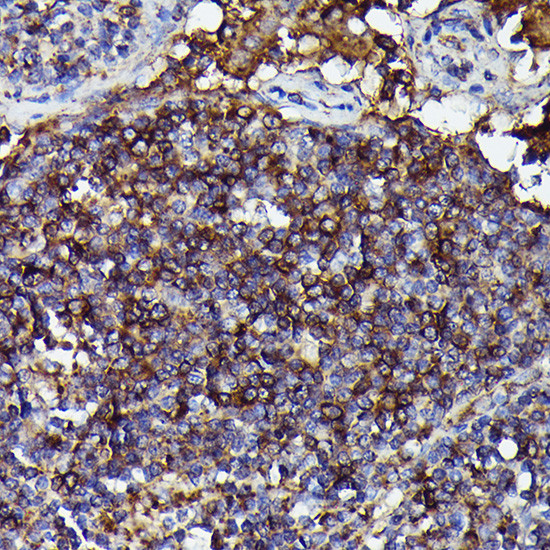 Human IgM Antibody in Immunohistochemistry (Paraffin) (IHC (P))