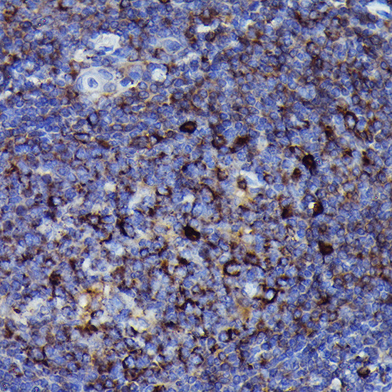 Human IgM Antibody in Immunohistochemistry (Paraffin) (IHC (P))