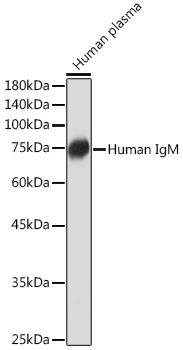 Human IgM Antibody in Western Blot (WB)