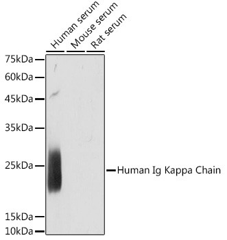 Kappa Light Chain Antibody in Western Blot (WB)