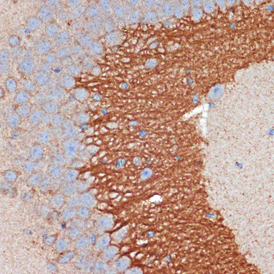 PRKAR2B Antibody in Immunohistochemistry (Paraffin) (IHC (P))