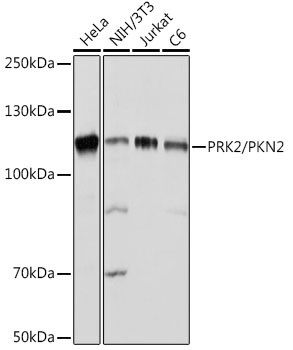 PKN2 Antibody in Western Blot (WB)