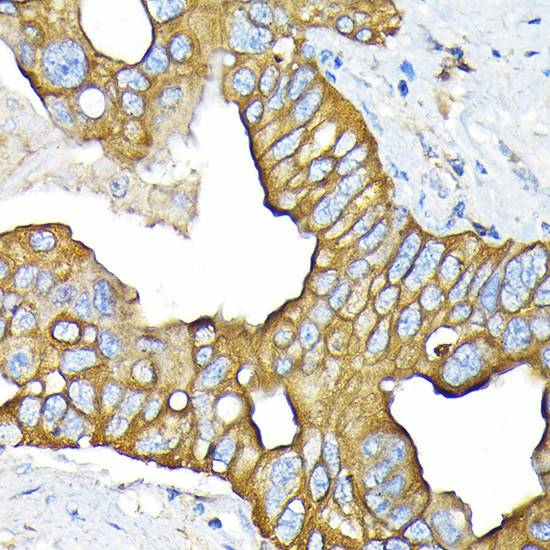 SLC22A3 Antibody in Immunohistochemistry (Paraffin) (IHC (P))