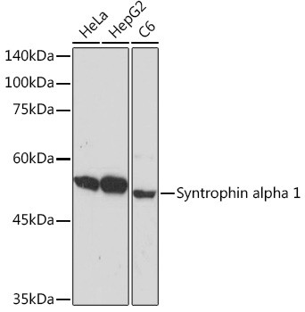 Syntrophin alpha-1 Antibody in Western Blot (WB)