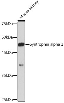 Syntrophin alpha-1 Antibody in Western Blot (WB)