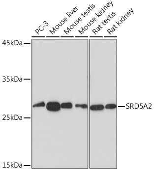 SRD5A2 Antibody in Western Blot (WB)